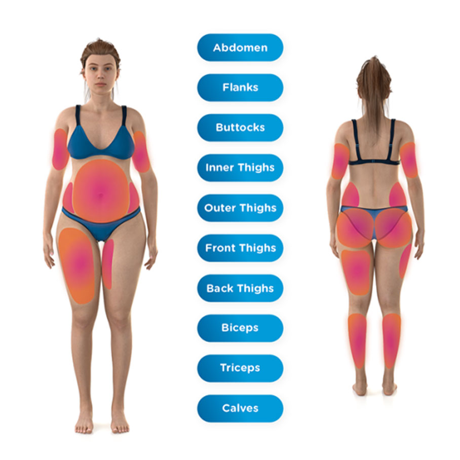 Diagram showing targeted areas of body sculpting in Cherry Hill, NJ