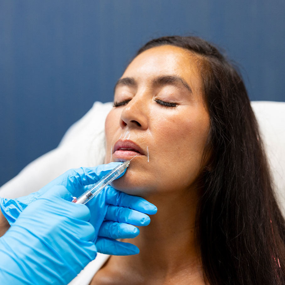 woman receiving Restylane dermal filler in Green Hills, TN