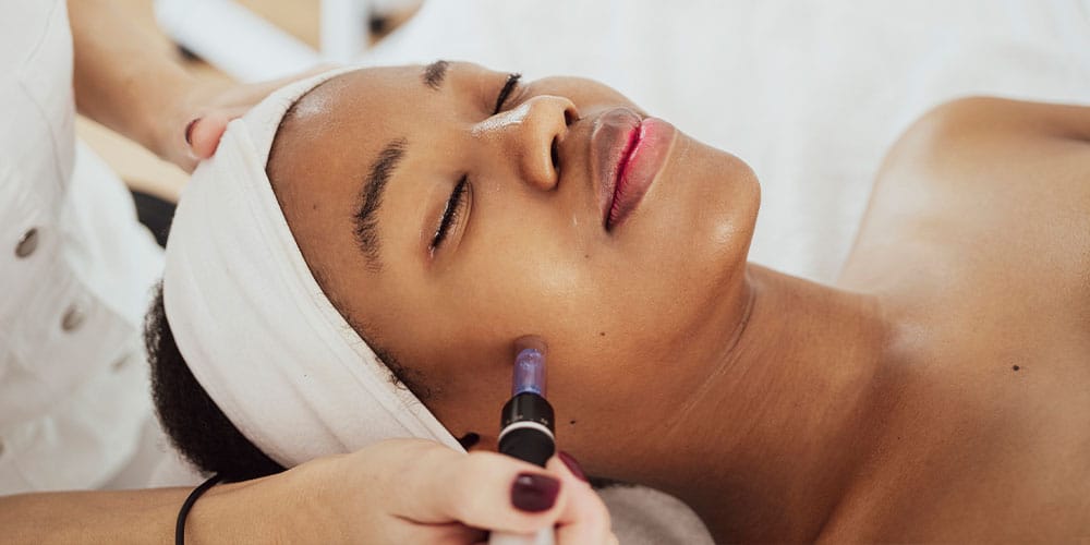woman receiving microneedling treatment
