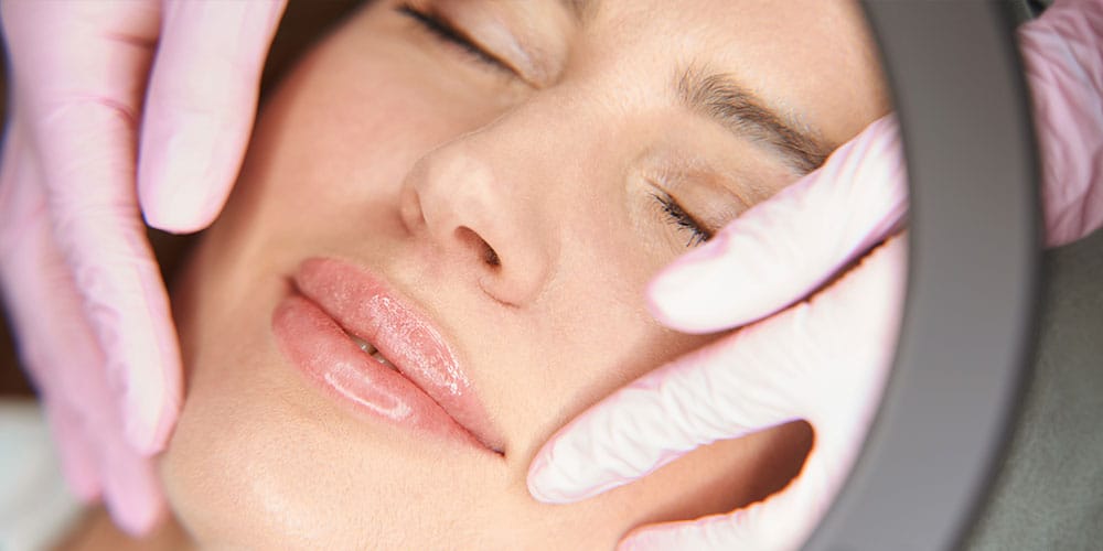 woman after getting lip filler